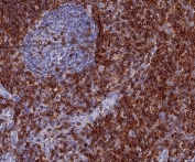 IHC staining of FFPE human tonsil tissue with CD7 antibody (clone CD7/3868R). HIER: boil tissue sections in pH 9 10mM Tris with 1mM EDTA for 20 min and allow to cool before testing.