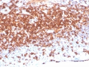 IHC staining of FFPE human lymph node tissue with CD7 antibody (clone CD7/3868R). HIER: boil tissue sections in pH 9 10mM Tris with 1mM EDTA for 20 min and allow to cool before testing.