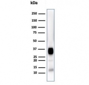 Western blot testing of human Jurkat cell lysate with CD7 antibody (clone CD7/3868R). Expected molecular weight: 25-40 kDa depending on glycosylation level.