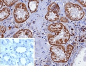 IHC staining of FFPE human kidney tissue with CD7 antibody (clone CD7/3868R). Inset: PBS used in place of primary Ab (secondary Ab negative control). HIER: boil tissue sections in pH 9 10mM Tris with 1mM EDTA for 20 min and allow to cool before testing.