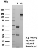 SDS-PAGE analysis of purified, BSA-free DSG3 antibody (clone rDSG3/8612) as confirmation of integrity and purity.