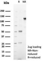 SDS-PAGE analysis of purified, BSA-free Desmoglein 3 antibody (clone DSG3/8251R) as confirmation of integrity and purity.