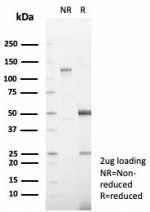 SDS-PAGE analysis of purified, BSA-free DSG3 antibody (clone DSG3/8252R) as confirmation of integrity and purity.