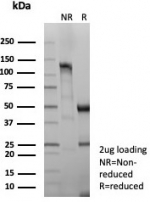 SDS-PAGE analysis of purified, BSA-free Desmoglein 3 antibody (clone DSG3/8613R) as confirmation of integrity and purity.