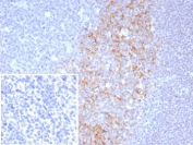 IHC staining of FFPE human tonsil tissue with CD23 antibody (clone FCER2/8511R). Inset: PBS used in place of primary Ab (secondary Ab negative control). HIER: boil tissue sections in pH 9 10mM Tris with 1mM EDTA for 20 min and allow to cool before testing.