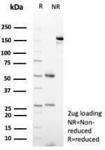 SDS-PAGE analysis of purified, BSA-free CD23 antibody (clone FCER2/8234R) as confirmation of integrity and purity.