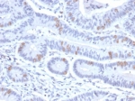 IHC staining of FFPE human colon tissue with HMG20B antibody (clone PCRP-HMG20B-1B5). HIER: boil tissue sections in pH 9 10mM Tris with 1mM EDTA for 20 min and allow to cool before testing.