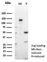 SDS-PAGE analysis of purified, BSA-free CD23 antibody (clone FCER2/8509R) as confirmation of integrity and purity.