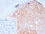 IHC staining of FFPE human tonsil tissue with CD23 antibody (clone FCER2/8509R). Inset: PBS used in place of primary Ab (secondary Ab negative control). HIER: boil tissue sections in pH 9 10mM Tris with 1mM EDTA for 20 min and allow to cool before testing.