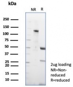 SDS-PAGE analysis of purified, BSA-free CD23 antibody (clone FCER2/8510R) as confirmation of integrity and purity.