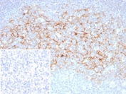 IHC staining of FFPE human tonsil tissue with CD23 antibody (clone FCER2/8510R). Inset: PBS used in place of primary Ab (secondary Ab negative control). HIER: boil tissue sections in pH 9 10mM Tris with 1mM EDTA for 20 min and allow to cool before testing.