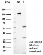 SDS-PAGE analysis of purified, BSA-free CD23 antibody (clone FCER2/8235R) as confirmation of integrity and purity.