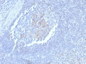 IHC staining of FFPE human tonsil tissue with CD23 antibody (clone FCER2/8235R). HIER: boil tissue sections in pH 9 10mM Tris with 1mM EDTA for 20 min and allow to cool before testing.