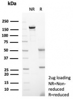 SDS-PAGE analysis of purified, BSA-free CD23 antibody (clone FCER2/8237R) as confirmation of integrity and purity.