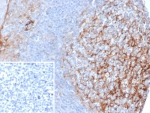 IHC staining of FFPE human tonsil tissue with ICAM-1 antibody (clone ICAM1/6606). Inset: PBS used in place of primary Ab (secondary Ab negative control). HIER: boil tissue sections in pH 9 10mM Tris with 1mM EDTA for 20 min and allow to cool before testing.