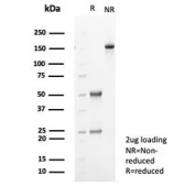 SDS-PAGE analysis of purified, BSA-free TGF beta antibody (clone TGFB/7240) as confirmation of integrity and purity.