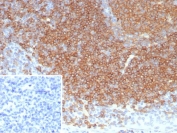 IHC staining of FFPE human tonsil tissue with CD22 antibody (clone BLCAM/8113R). Inset: PBS instead of primary antibody, secondary control.