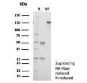 SDS-PAGE analysis of purified, BSA-free Kallikrein 5 antibody (clone KLK5/4759) as confirmation of integrity and purity.