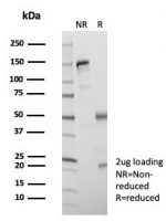 SDS-PAGE analysis of purified, BSA-free Kinesin-like protein 6 antibody (clone KIF2C/6524) as confirmation of integrity and purity.