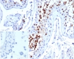 IHC staining of FFPE human testis tissue with Kinesin-like protein 6 antibody (clone KIF2C/6524) at 2ug/ml. Inset: PBS used in place of primary Ab (secondary Ab negative control). HIER: boil tissue sections in pH 9 10mM Tris with 1mM EDTA for 20 min and allow to cool before testing.