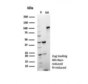 SDS-PAGE analysis of purified, BSA-free recombinant LFA-2 antibody (clone rLFA2/8516) as confirmation of integrity and purity.