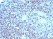 IHC staining of FFPE human tonsil tissue with recombinant LFA-2 antibody (clone rLFA2/8516) HIER: boil tissue sections in pH 9 10mM Tris with 1mM EDTA for 20 min and allow to cool before testing.