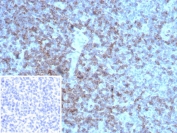 IHC staining of FFPE human tonsil tissue with recombinant LFA-2 antibody (clone rLFA2/8516) Inset: PBS used in place of primary Ab (secondary Ab negative control). HIER: boil tissue sections in pH 9 10mM Tris with 1mM EDTA for 20 min and allow to cool before testing.