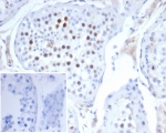 IHC staining of FFPE human testis tissue with KIF2C antibody (clone KIF2C/4702) at 2ug/ml. Inset: PBS used in place of primary Ab (secondary Ab negative control). HIER: boil tissue sections in pH 9 10mM Tris with 1mM EDTA for 20 min and allow to cool before testing.