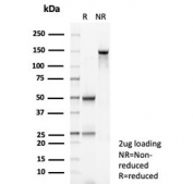 SDS-PAGE analysis of purified, BSA-free recombinant GSTM3 antibody (clone rGSTM3/8878) as confirmation of integrity and purity.