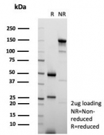 SDS-PAGE analysis of purified, BSA-free MCAK antibody (clone KIF2C/6522) as confirmation of integrity and purity.