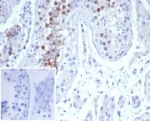 IHC staining of FFPE human testis tissue with MCAK antibody (clone KIF2C/6522) at 2ug/ml. Inset: PBS used in place of primary Ab (secondary Ab negative control). HIER: boil tissue sections in pH 9 10mM Tris with 1mM EDTA for 20 min and allow to cool before testing.