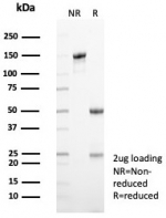 SDS-PAGE analysis of purified, BSA-free KIF2C antibody (clone KIF2C/6525) as confirmation of integrity and purity.
