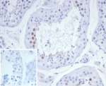 IHC staining of FFPE human testis tissue with KIF2C antibody (clone KIF2C/6525) at 2ug/ml. Inset: PBS used in place of primary Ab (secondary Ab negative control). HIER: boil tissue sections in pH 9 10mM Tris with 1mM EDTA for 20 min and allow to cool before testing.
