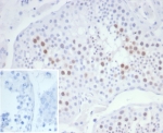 IHC staining of FFPE human testis tissue with KIF2C antibody (clone KIF2C/6526) at 2ug/ml. Inset: PBS used in place of primary Ab (secondary Ab negative control). HIER: boil tissue sections in pH 9 10mM Tris with 1mM EDTA for 20 min and allow to cool before testing.