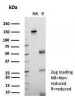 SDS-PAGE analysis of purified, BSA-free KNSL6 antibody (clone KIF2C/6529) as confirmation of integrity and purity.
