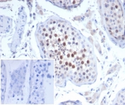 IHC staining of FFPE human testis tissue with Kinesin like protein 6 antibody (clone KIF2C/4704) at 2ug/ml. Inset: PBS used in place of primary Ab (secondary Ab negative control). HIER: boil tissue sections in pH 9 10mM Tris with 1mM EDTA for 20 min and allow to cool before testing.