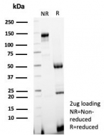 SDS-PAGE analysis of purified, BSA-free KIF2C antibody (clone KIF2C/4706) as confirmation of integrity and purity.