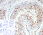 IHC staining of FFPE human testis tissue with KIF2C antibody (clone KIF2C/4706) at 2ug/ml. Inset: PBS used in place of primary Ab (secondary Ab negative control). HIER: boil tissue sections in pH 9 10mM Tris with 1mM EDTA for 20 min and allow to cool before testing.