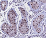 IHC staining of FFPE human testis tissue with Kinesin Family Member 2C antibody (clone KIF2C/4707) at 2ug/ml. HIER: boil tissue sections in pH 9 10mM Tris with 1mM EDTA for 20 min and allow to cool before testing.