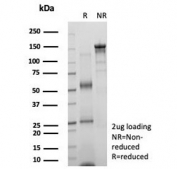 SDS-PAGE analysis of purified, BSA-free KIF2C antibody (clone KIF2C/6519) as confirmation of integrity and purity.