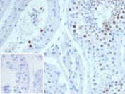IHC staining of FFPE human testis tissue with KIF2C antibody (clone KIF2C/6519) at 2ug/ml. Inset: PBS used in place of primary Ab (secondary Ab negative control). HIER: boil tissue sections in pH 9 10mM Tris with 1mM EDTA for 20 min and allow to cool before testing.