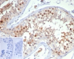IHC staining of FFPE human testis tissue with KIF2C antibody (clone KIF2C/6528) at 2ug/ml. Inset: PBS used in place of primary Ab (secondary Ab negative control). HIER: boil tissue sections in pH 9 10mM Tris with 1mM EDTA for 20 min and allow to cool before testing.