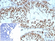 IHC staining of FFPE human testis tissue with KIF2C antibody (clone KIF2C/4705) at 2ug/ml. Inset: PBS used in place of primary Ab (secondary Ab negative control). HIER: boil tissue sections in pH 9 10mM Tris with 1mM EDTA for 20 min and allow to cool before testing.