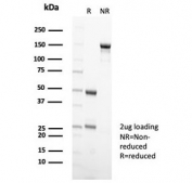 SDS-PAGE analysis of purified, BSA-free Kinesin like protein 6 antibody (clone KIF2C/6520) as confirmation of integrity and purity.