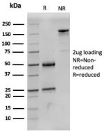 SDS-PAGE analysis of purified, BSA-free Succinate dehydrogenase B antibody (clone SDHB/3204) as confirmation of integrity and purity.