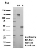 SDS-PAGE analysis of purified, BSA-free recombinant GLUL antibody (clone rGLUL/8620) as confirmation of integrity and purity.