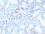 IHC staining of FFPE human kidney tissue with ROR gamma antibody (clone RORC/8017R). Inset: PBS used in place of primary Ab (secondary Ab negative control). HIER: boil tissue sections in pH 9 10mM Tris with 1mM EDTA for 20 min and allow to cool before testing.