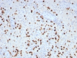 IHC staining of FFPE human brain tissue with GLUL antibody (clone GLUL/8996R). HIER: boil tissue sections in pH 9 10mM Tris with 1mM EDTA for 20 min and allow to cool before testing.