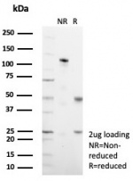 SDS-PAGE analysis of purified, BSA-free Mucin 1 antibody (clone MUC1/7797R) as confirmation of integrity and purity.