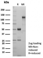 SDS-PAGE analysis of purified, BSA-free GLUL antibody (clone rGLUL/8621) as confirmation of integrity and purity.